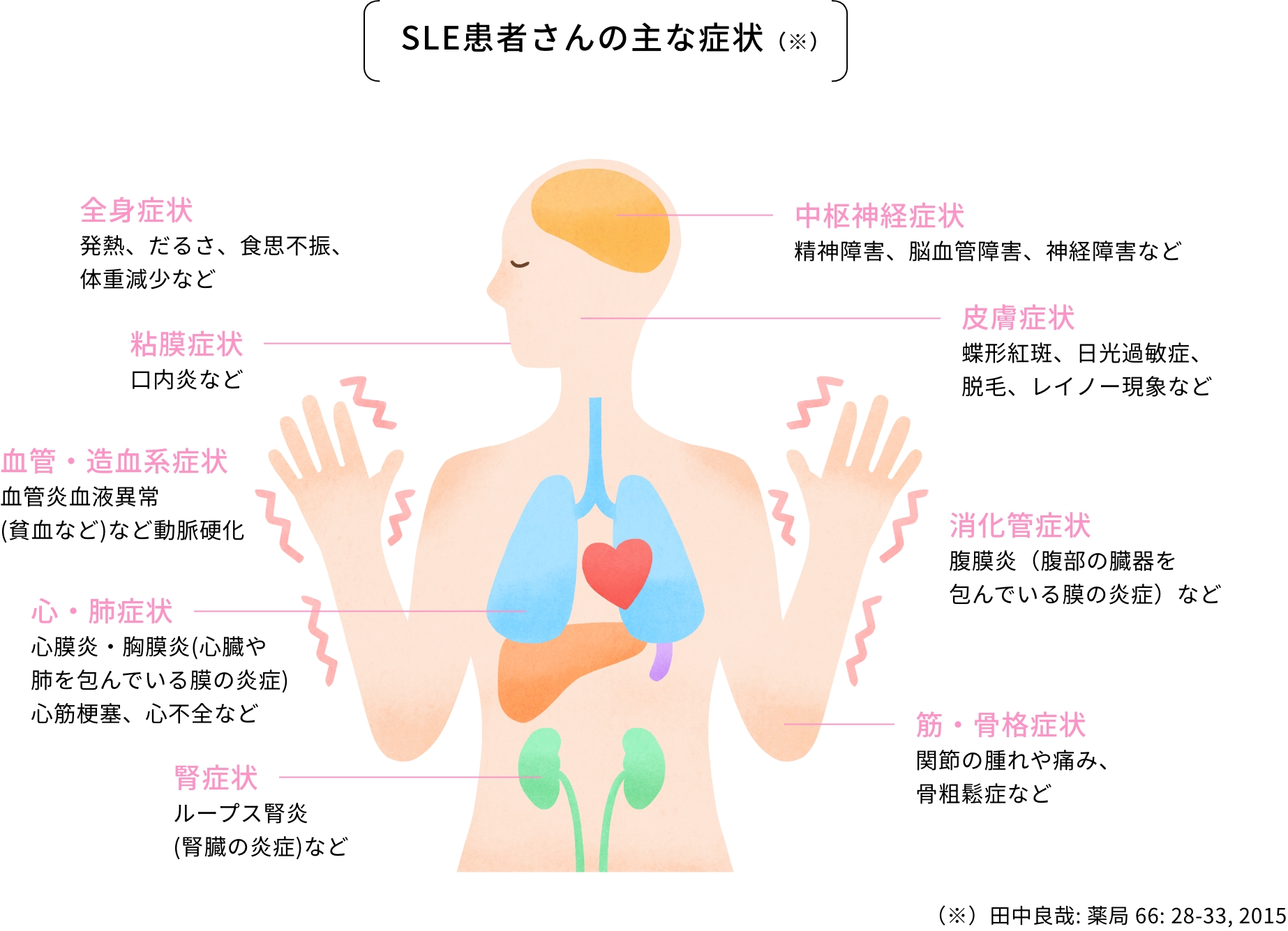 SLE患者さんの主な症状（※）